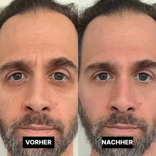 Vorher/Nachher