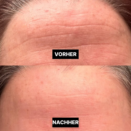 Vorher/Nachher